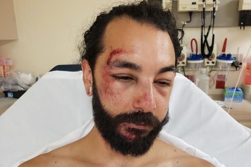 Medeiros is recovering from the accident.
