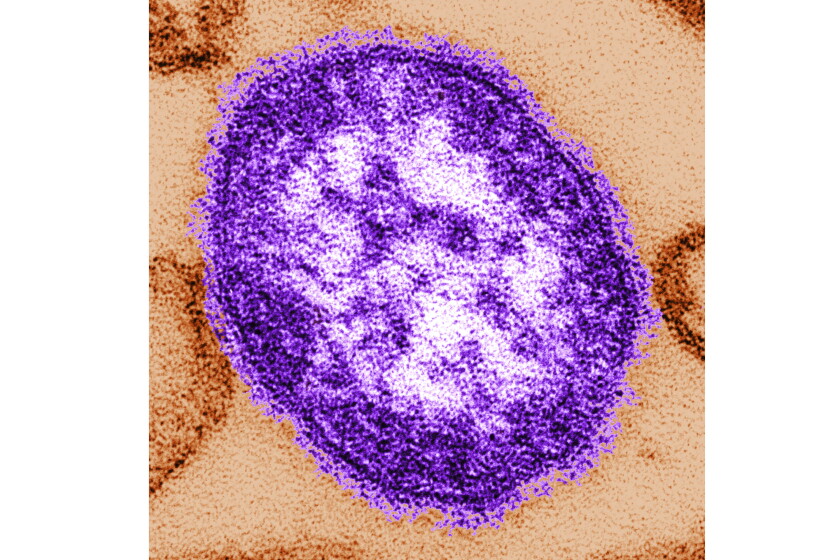 A resident in DuPage County tested positive for the measles virus.