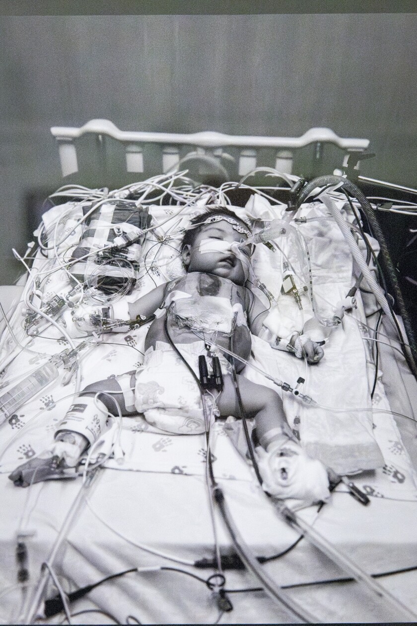 Marely when she was once gathered in a sanatorium. Marely Chavarria Santos was once born with a failing heart and had a transplant at Lurie Kid's Scientific institution. Medicaid will pay for her to are living at house, along with gear to retain her alive and a nurse to luxuriate in her.