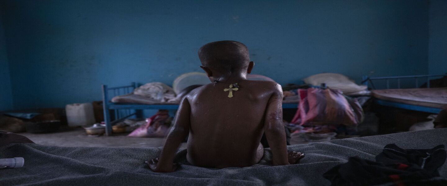 Micheale Gebremariam waits for his father Abraha Kinfe Gebremariam to bathe him after waking up early in their shelter in Hamdayet, eastern Sudan, near the border with Ethiopia.