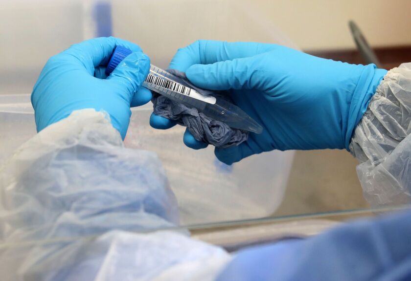 A lab technician cleans a test tube containing a live sample taken from people tested for the novel coronavirus at a facility in Scotland.