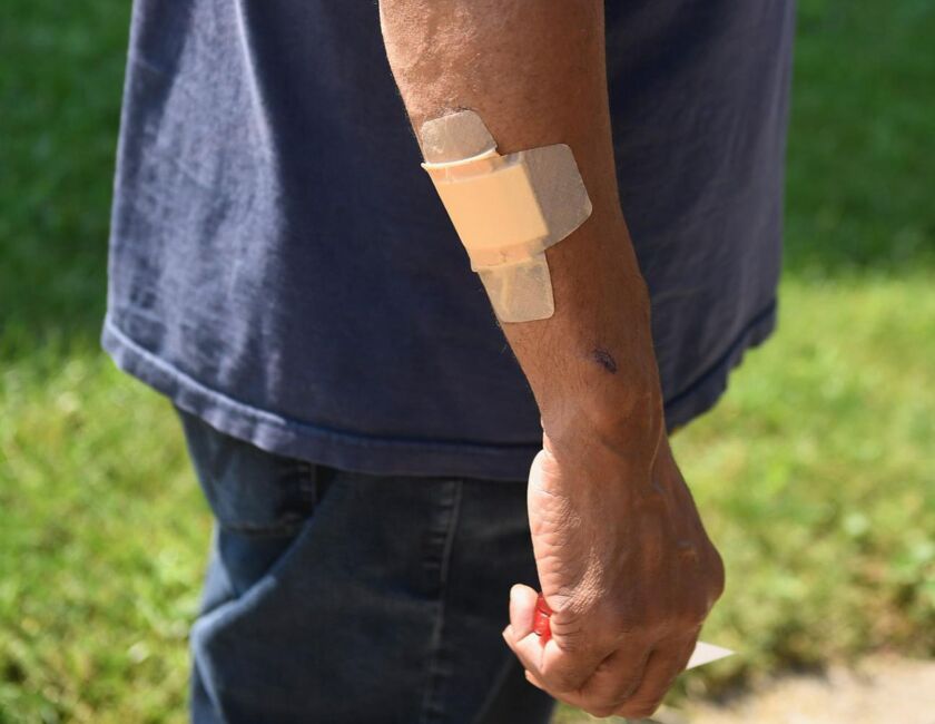Graze wound from a drive-by shooting in Gresham in which two women died.