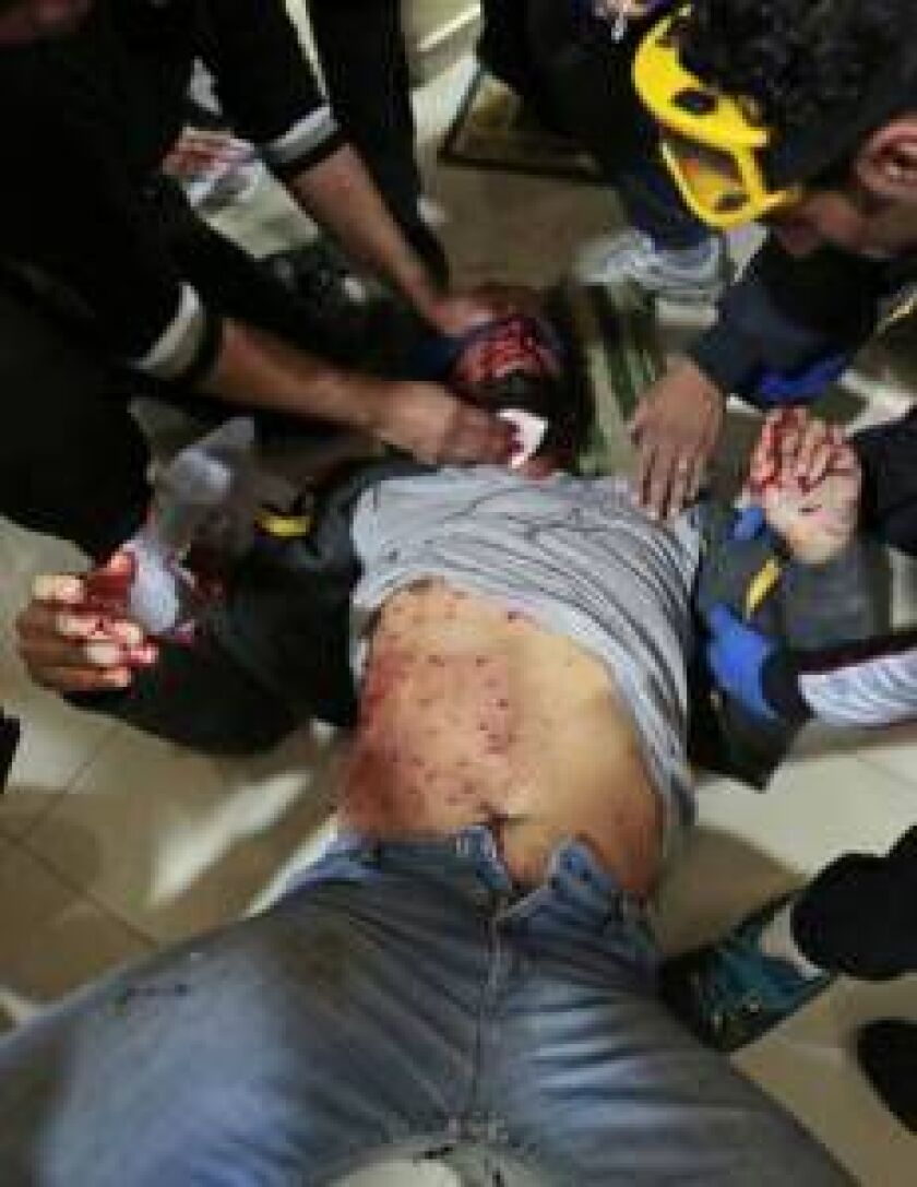 Bahraini anti-government protesters check the birdshot injuries to a fellow protester during clashes between protesters largely throwing stones and police firing tear gas and firing shotguns, Tuesday, Jan. 20, 2015, in Bilad al-Qadeem, Bahrain. (AP Photo/