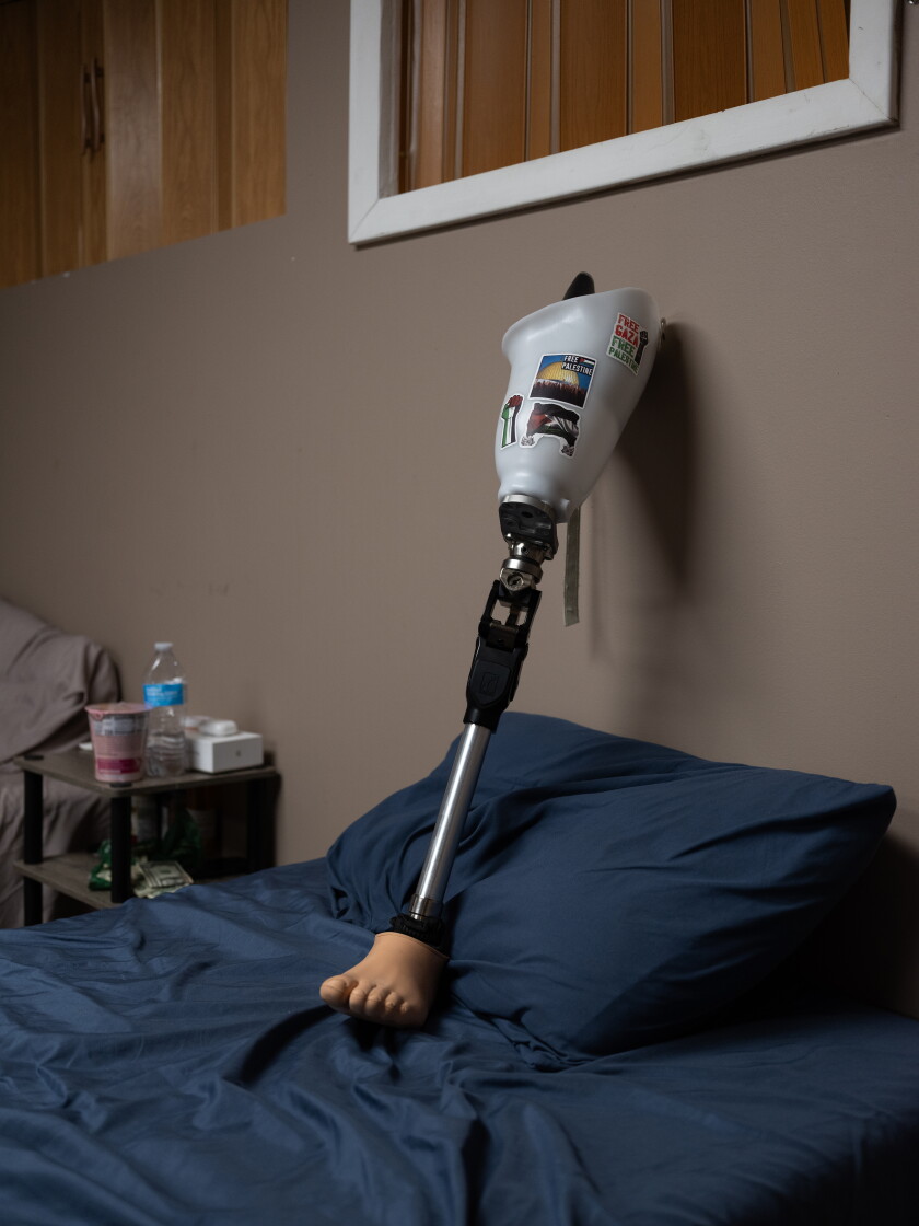 One False Leg Palestinian teen injured in Gaza tries to walk again in Chicago suburbs ...