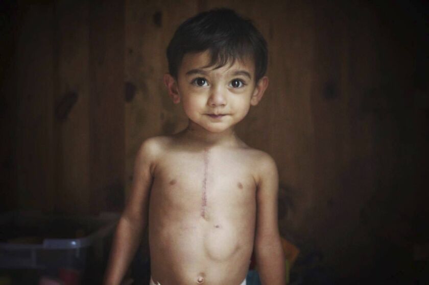 Ethan Chandra, 3, of Middlesex, N.J., suffers from heterotaxy syndrome, a rare genetic disorder that causes organs to form incorrectly or in the wrong place. | Alison Chandra photo
